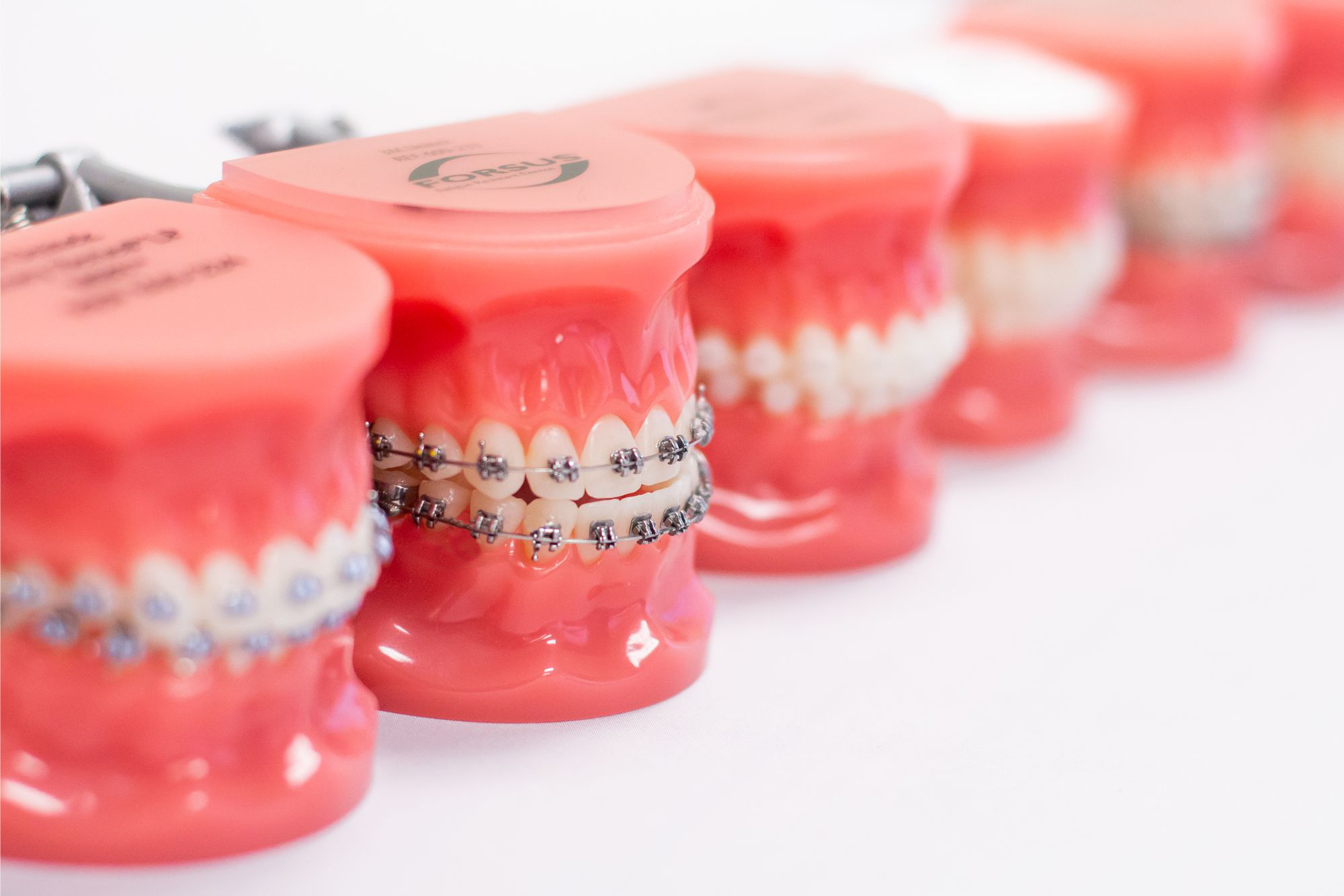 Orthodontic treatment options